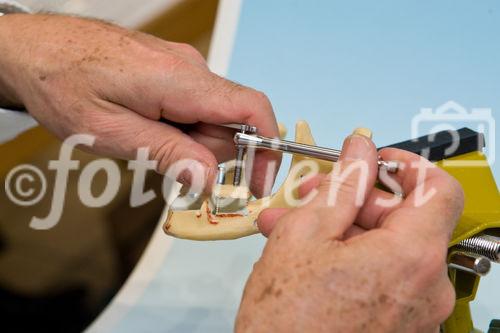 2nd Endodistraction Course - 
Distraction Osteogenesis of the Mandible
and Maxilla the new Technique Single
Endodistraction Implant KRENKEL®.
(C)fotodienst/Christian Hofer