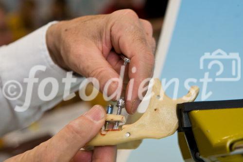 2nd Endodistraction Course - 
Distraction Osteogenesis of the Mandible
and Maxilla the new Technique Single
Endodistraction Implant KRENKEL®.
(C)fotodienst/Christian Hofer