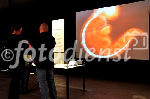 Embryonale Kunstwerke an der Leinwand und im Reagenzglas, sezierte Gliedmassen und Innereien, das sind für viele anstössige Schweinereien. Gunter von HAgens Ausstellung provoziert die erhitzten Gemüter. 